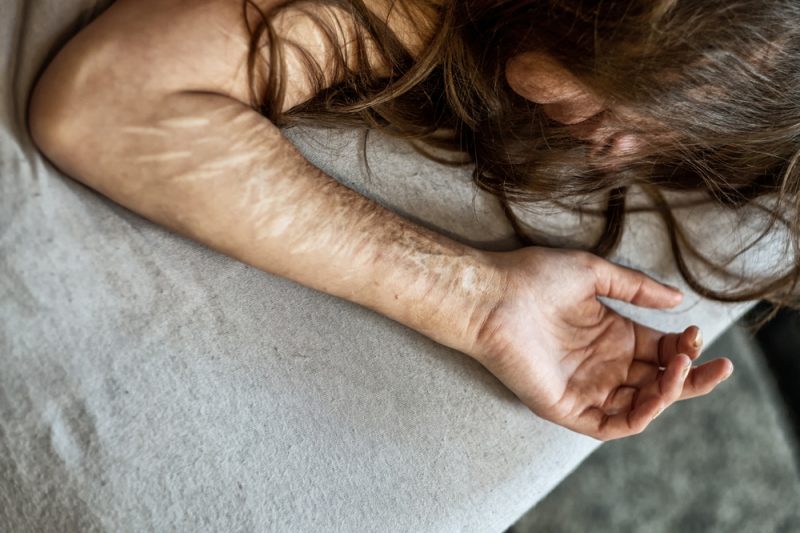Hand,,Arm,And,Hair,Of,A,Woman,With,Heavy,Cuts